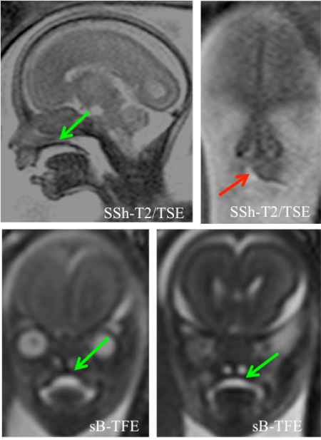 snímky z vyšetření magnetickou rezonancí snímky z vyšetření magnetickou rezonancí