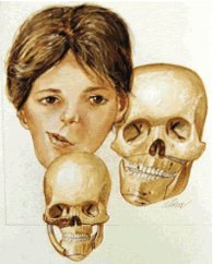 kresba dítěte s postižením ilustrační foto