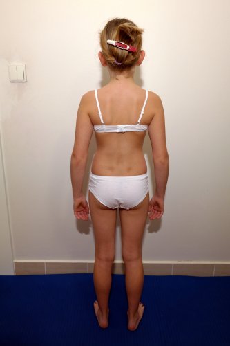 ilustrační foto: držení těla ilustrační foto: držení těla