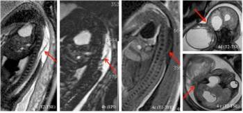 snímek z magnetické rezonance snímek z magnetické rezonance