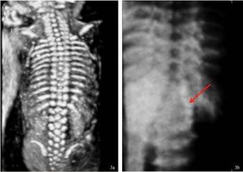 snímek z trojrozměrného ultrazvuku snímek z trojrozměrného ultrazvuku
