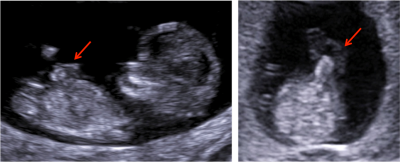 ultrazvukový snímek ultrazvukový snímek