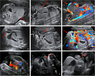 ultrazvukový snímek ultrazvukový snímek