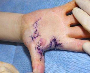 výsledek po operaci výsledek po operaci