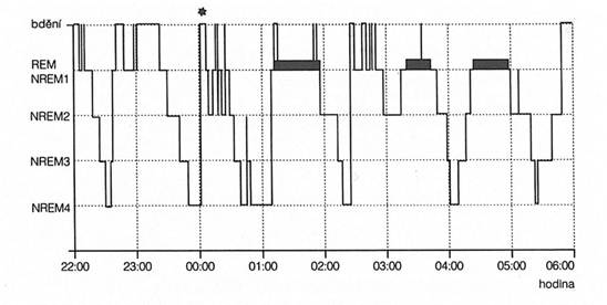 ilustrační obrázek - spící chlapec ilustrační obrázek - spící chlapec