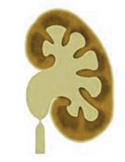 obrázek – schéma hydronefrózy