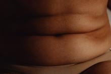 Obézní břicho
