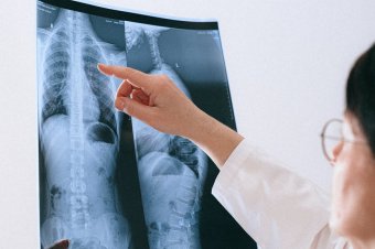 Lékařka studující rentgenový snímek [Fotografka Anna Shvets]